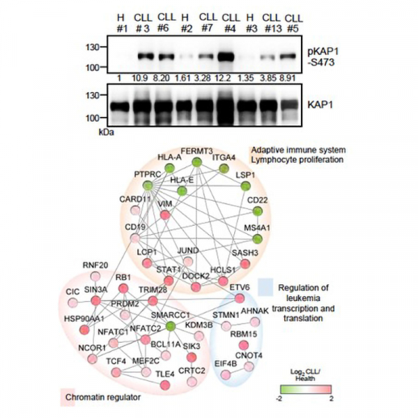 Phosphoproteomics reveals the role of constitutive KAP1 phosphorylation by B-cell receptor signaling in chronic lymphocytic leukemia Phosphoproteomics reveals the role of constitutive KAP1 phosphorylation by B-cell receptor signaling in chronic lymphocytic leukemia