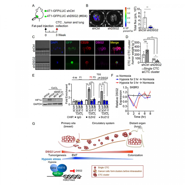 Interplay between desmoglein2 and hypoxia controls metastasis in breast cancer Interplay between desmoglein2 and hypoxia controls metastasis in breast cancer