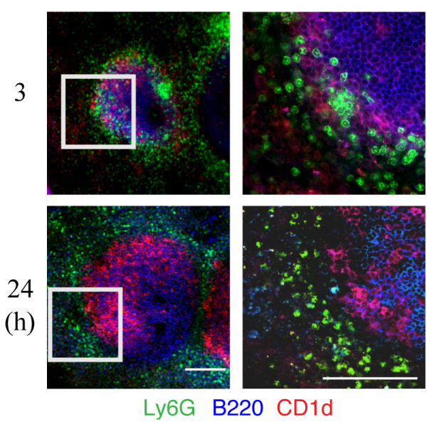 Marginal Zone B Cells Assist With Neutrophil Accumulation to Fight Against Systemic Staphylococcus aureus Infection Marginal Zone B Cells Assist With Neutrophil Accumulation to Fight Against Systemic Staphylococcus aureus Infection