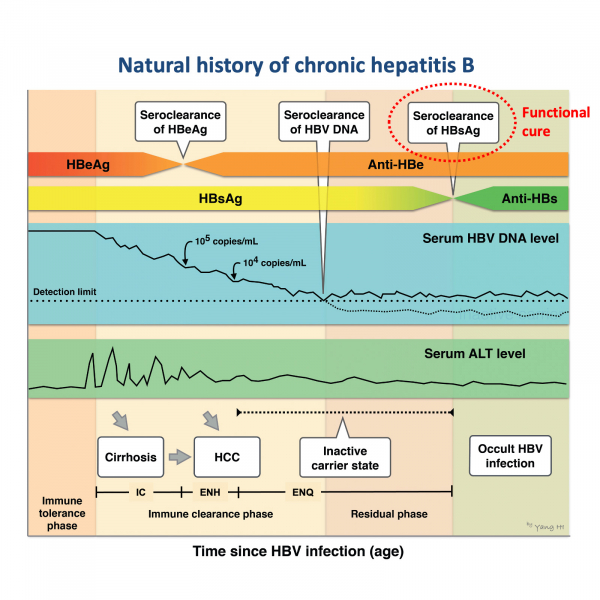 Serum soluble programmed cell death 1 levels predict spontaneous functional cure in inactive carriers with chronic hepatitis B Serum soluble programmed cell death 1 levels predict spontaneous functional cure in inactive carriers with chronic hepatitis B