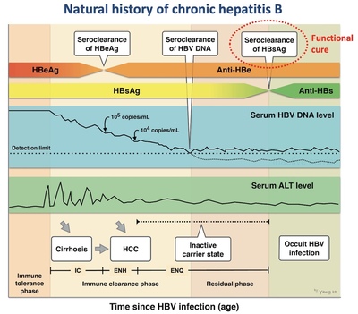 PD‐1 levels can predict spontaneous functional cure in inactive chronic hepatitis B carriers PD‐1 levels can predict spontaneous functional cure in inactive chronic hepatitis B carriers
