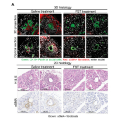 Oncogenic KRAS, Mucin 4, and Activin A-Mediated Fibroblast Activation Cooperate for PanIN Initiation